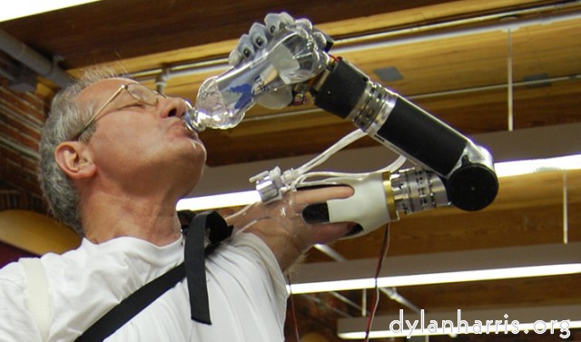 Prosthetic arm approved (arstechnica)